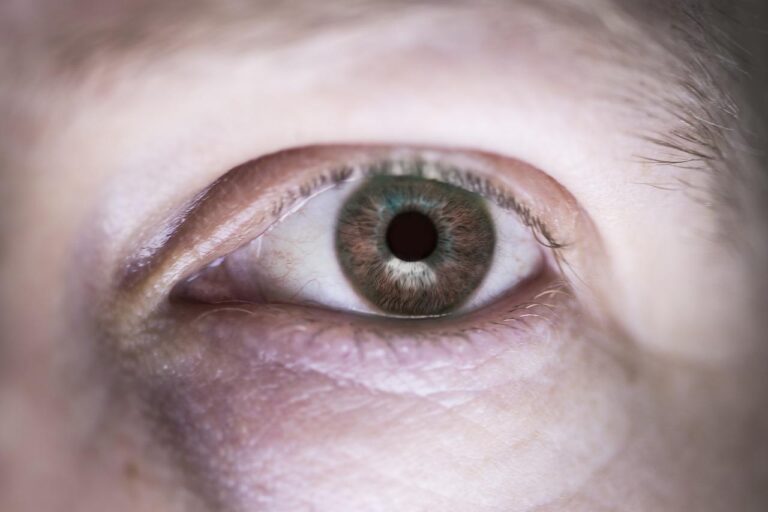 Is cosmetische chirurgie iets voor jou?